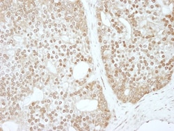 ZBTB40 Antibody, Novus Biologicals 0.1mL; Unlabeled:Anticuerpos